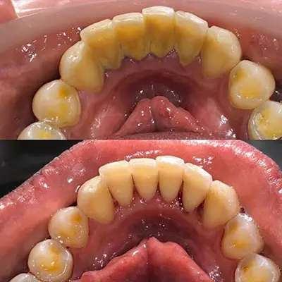 foto ilustrativa Prevenção